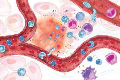 Wirkung von Boswellia auf entzündete Körperstellen